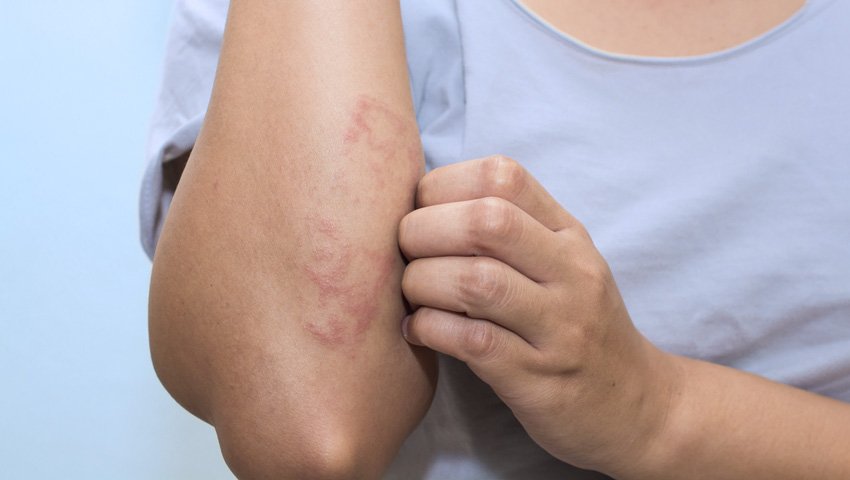 Las lesiones más comunes de la piel