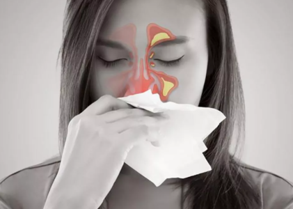 ¿Cómo Tratar la Sinusitis Crónica?