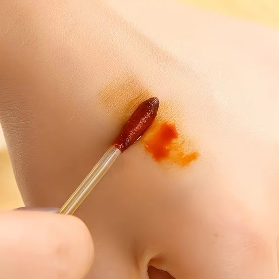 desinfección de heridas