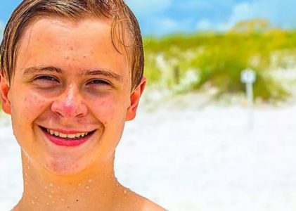 Skincare para Adolescentes